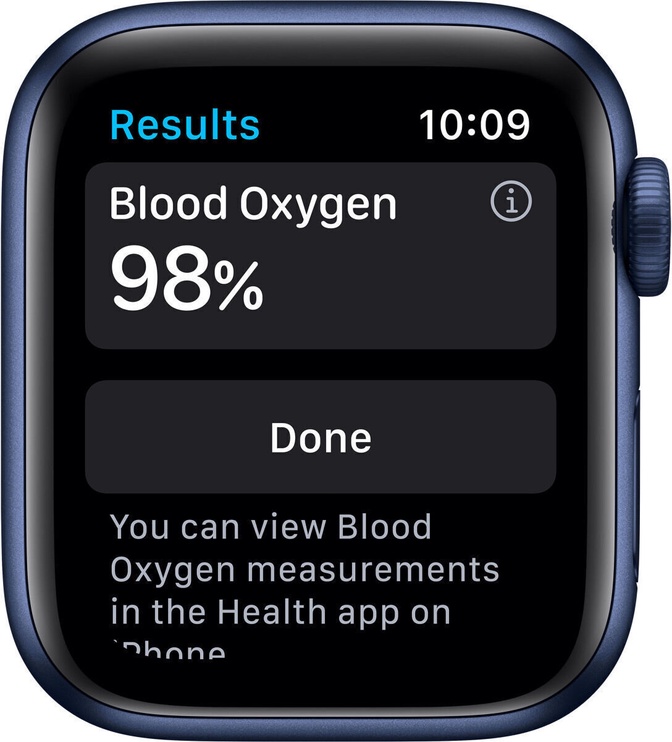Viedais pulkstenis Apple Watch 6 GPS + Cellular 40mm M06X3EL/A, zila